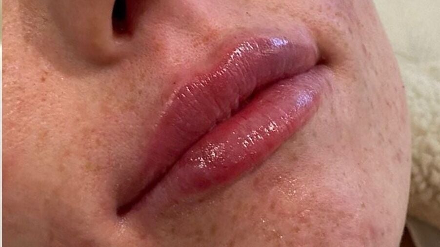 056679f0-4e1e-4b39-acd5-651c2d1280bc-femiclinicsaesthetics-gb-england-tarporley-fresha-8088363