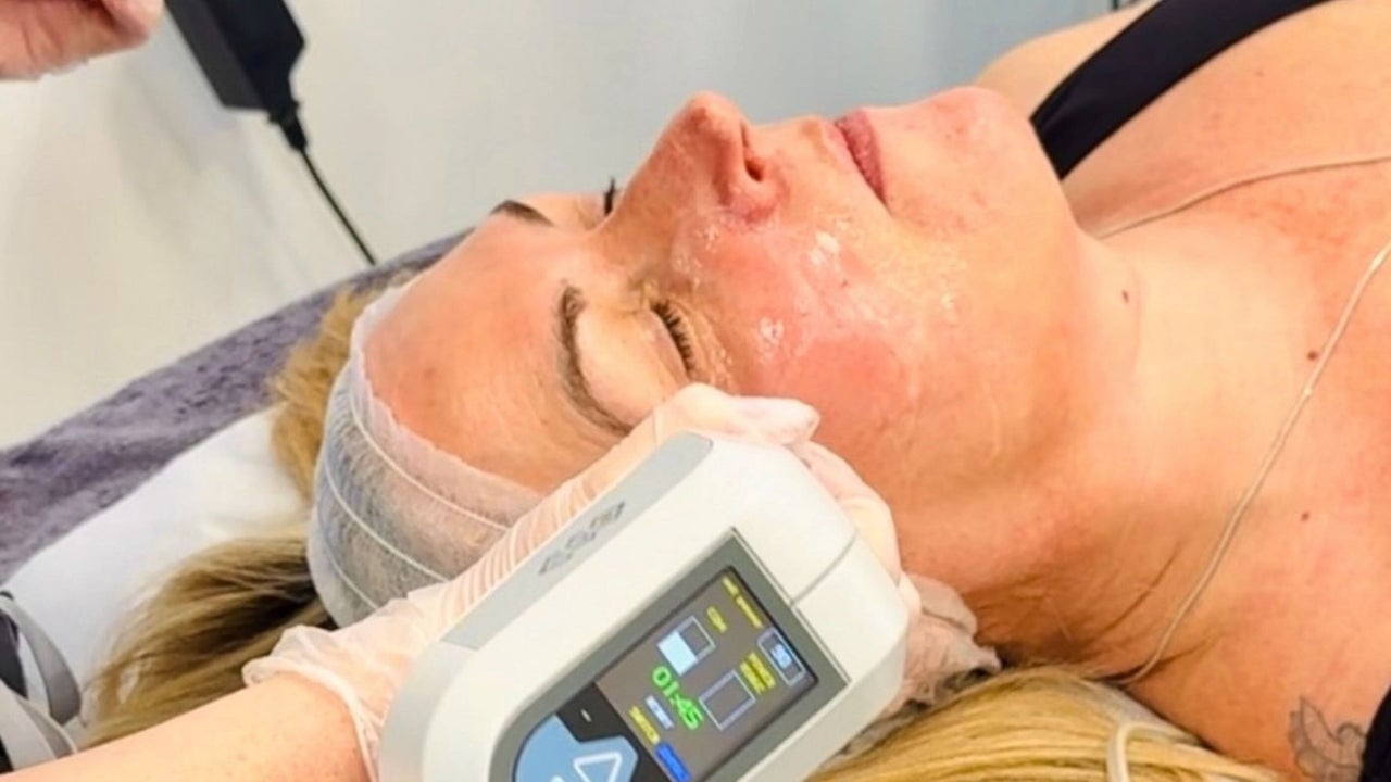 09134f51-7527-4235-a832-734d4f147061-harleyskinandlaser-gb-england-stoke-on-trent-porthill-fresha-1823662