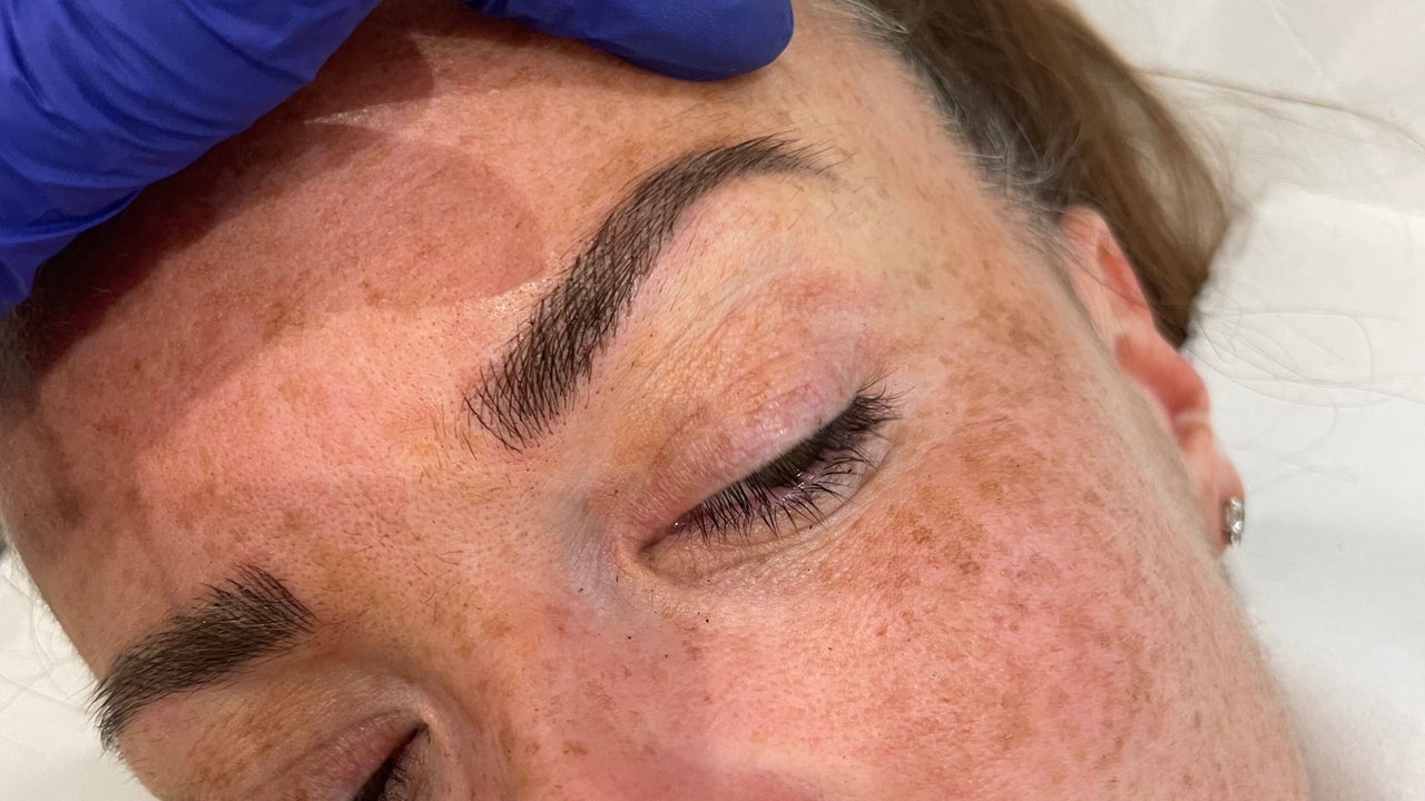 333d6c21-db7d-4360-ac07-2df465f0eb55-femiclinicsaesthetics-gb-england-tarporley-fresha-3571874