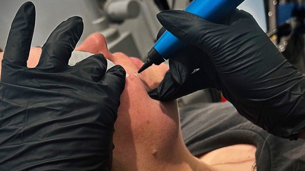 360065c9-37b9-42d7-a651-2ab6f6c9ee36-harleyskinandlaser-gb-england-stoke-on-trent-porthill-fresha-6439621