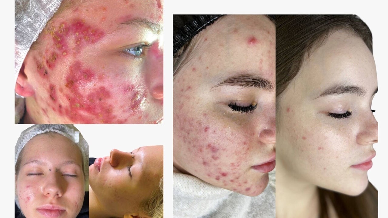 45356e7f-8b5f-4511-82f5-a5887d366959-beautouchaestheticclinicwaxnbeautystudio-gb-england-peterborough-centre-fresha-9680440