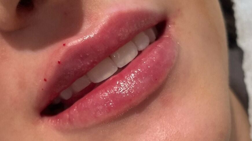 4fb66909-de34-4dc0-81fe-df5459a0c254-femiclinicsaesthetics-gb-england-tarporley-fresha-3939534