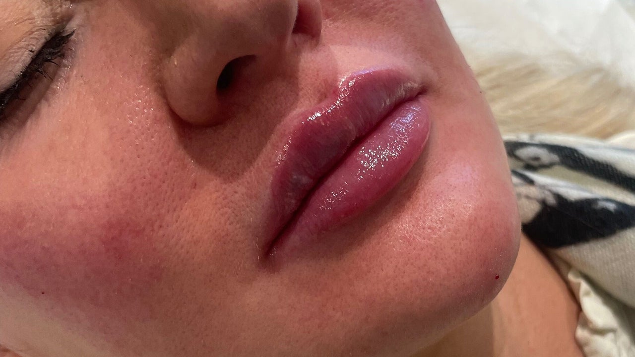 9b42e276-eaf8-4330-996b-bba98196a706-femiclinicsaesthetics-gb-england-tarporley-fresha-6543707