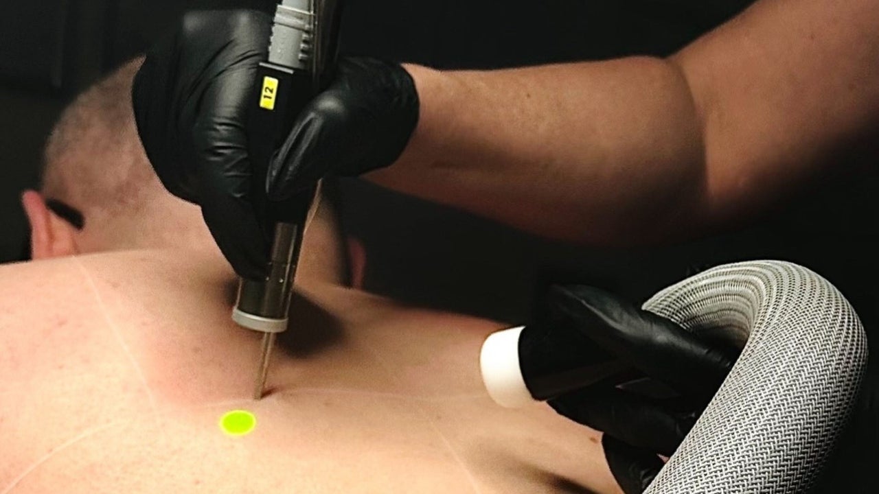 a4e66cb0-ef65-4823-a1ab-f70420618658-harleyskinandlaser-gb-england-stoke-on-trent-porthill-fresha-3178222