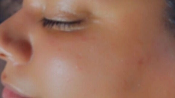 dd260f68-fea0-4aaf-86ea-2f9afb44d28f-justbeautylaserandskinclinic-gb-england-coventry-fresha-2783895