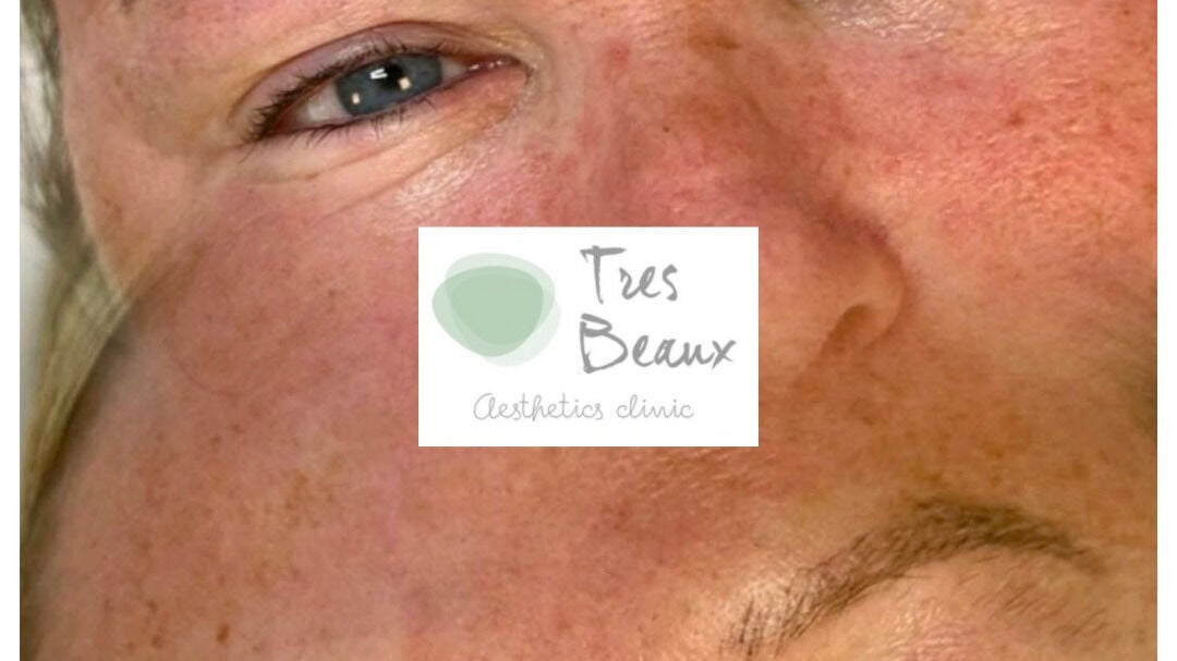 03b2326c-85a4-4e49-ad18-c156659a328a-tresbeauxaesthetics-gb-england-birmingham-kingsnorton-fresha-5996670