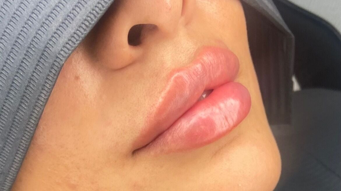 0474dfe7-e82d-438d-8ed2-eed0413c6704-readysetglowaestheticsltd-gb-england-birmingham-theroyaltownofsuttoncoldfield-fresha-9211532