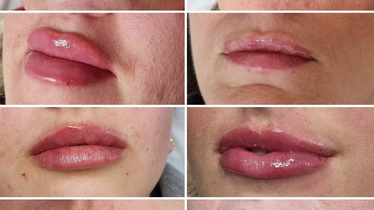 054d590d-462b-42e7-8a08-6c8f93453f72-4779740