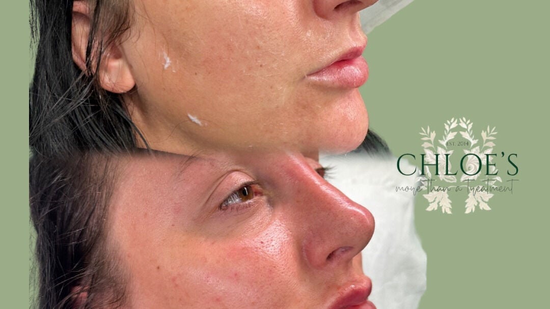 05b136e8-6a77-40c1-8d2c-9d5e8f345ab4-chloes-gb-england-talkepits-fresha-9022037