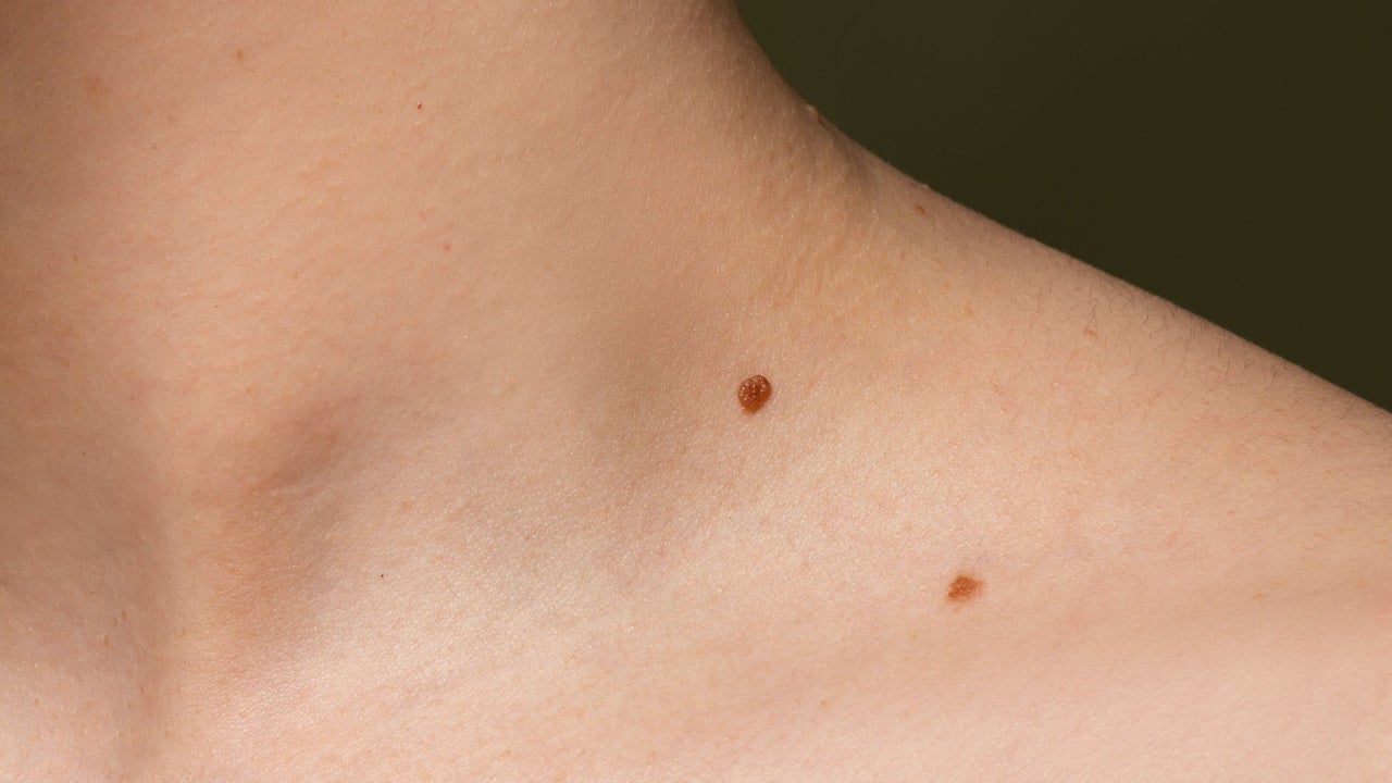 06f4d1db-9a72-49f2-add6-2c195b7377e0-chathamfootcareclinicandskintagremoval-gb-england-aylesford-fresha-8777867