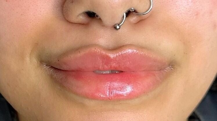 071d1774-40e2-4d14-9b17-66199d763b21-aspinallaesthetics-gb-england-kingswood-369-375twomilehillroad-fresha-1315482