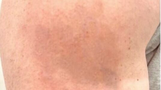 086dc406-d035-4bfd-8113-29d357ffad62-4394924