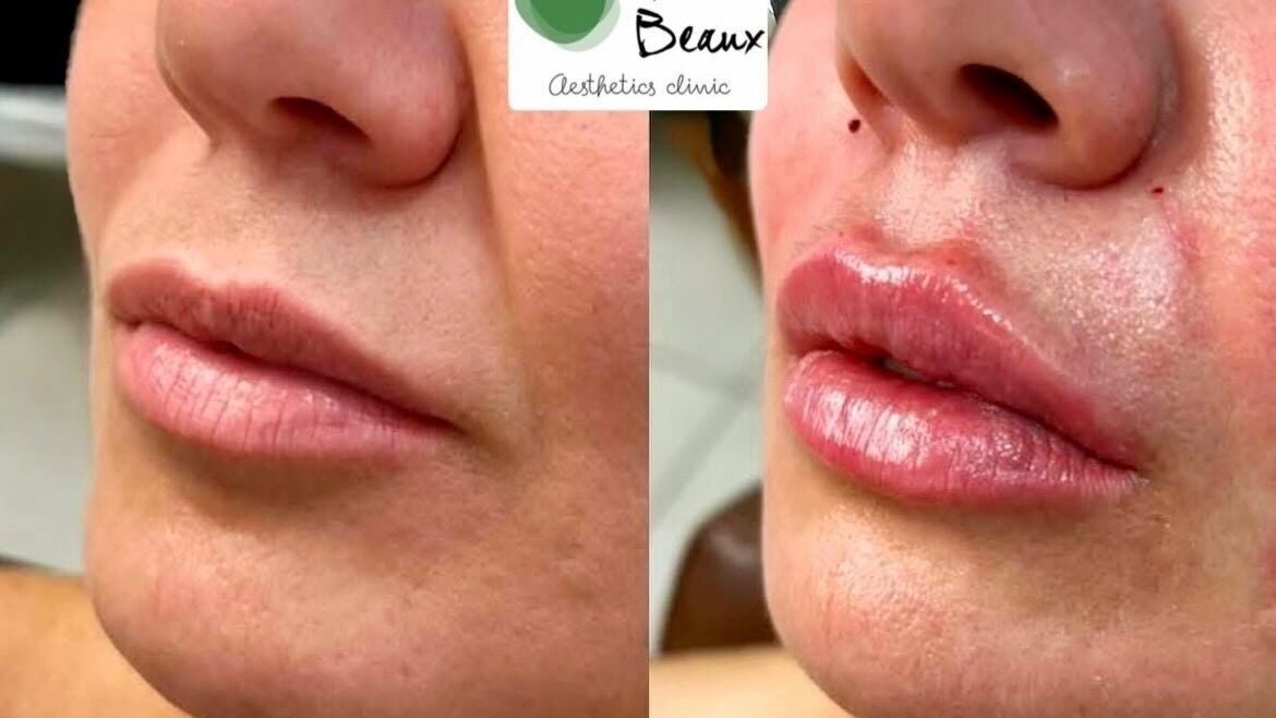 09292282-40b8-46a9-bc40-053117b28223-tresbeauxaesthetics-gb-england-birmingham-kingsnorton-fresha-7959898