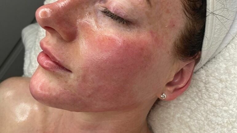 098551c5-9dc7-4429-8591-7a20c99f2c57-2012311