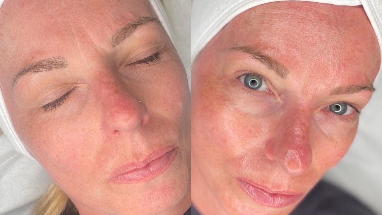 09cf628d-fc46-4037-b9d0-c8eccee595a5-karrinacrystallpmulaestheticsskinlbeauty-gb-england-leeds-eastgarforth-fresha-5428147