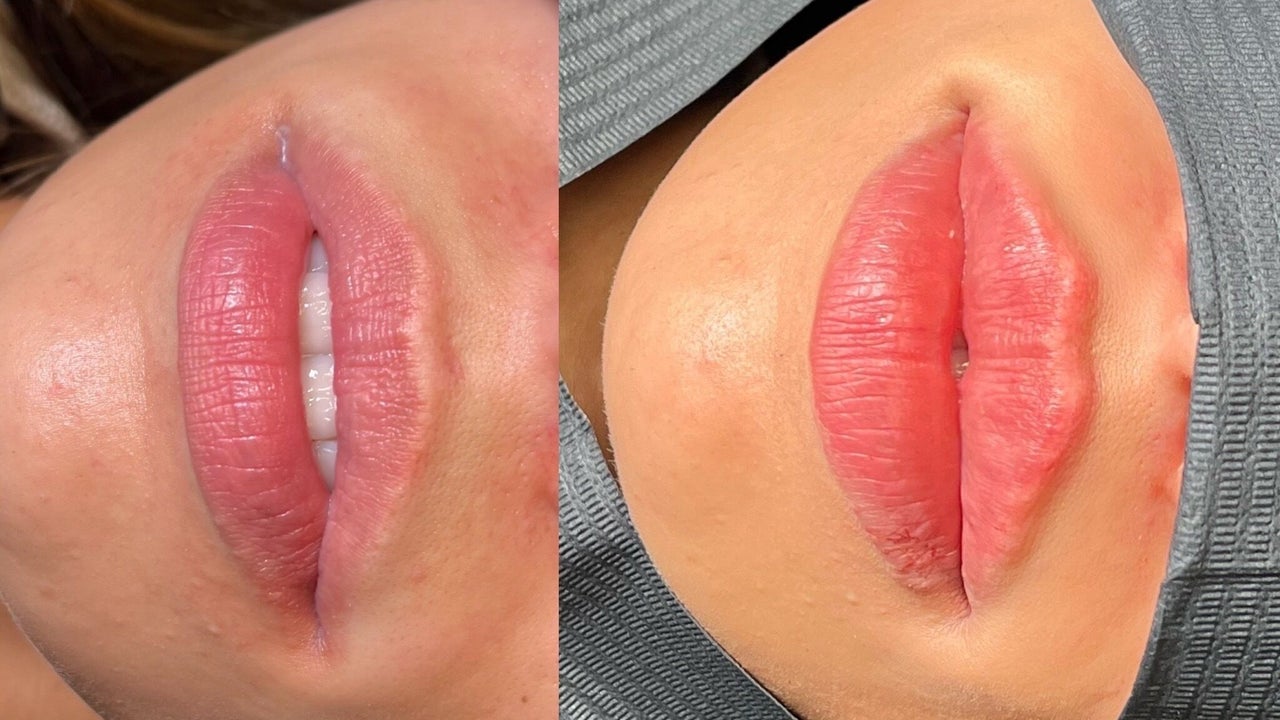 0a42d1db-b863-4538-8201-56c77724c910-bellamacaestheticsmanchester-gb-england-tyldesley-manchester-fresha-7219738