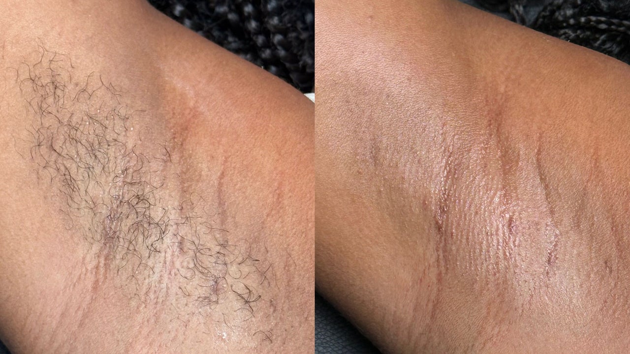 0aacd97d-3d3c-4f9d-8285-6e821986c067-smoovebeauty-gb-england-stoke-on-trent-fenton-fresha-9855510