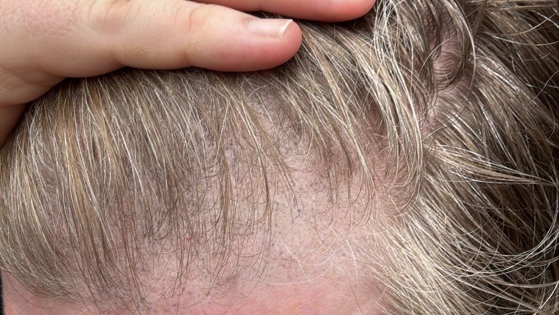 0af844c1-93e7-4cdd-a066-fcdfa5d5dd83-tiffanymacdonald-permanentmakeup-finelinetattoo-advancedskincare-laser-aesthetics-gb-england-weybridge-fresha-9057699