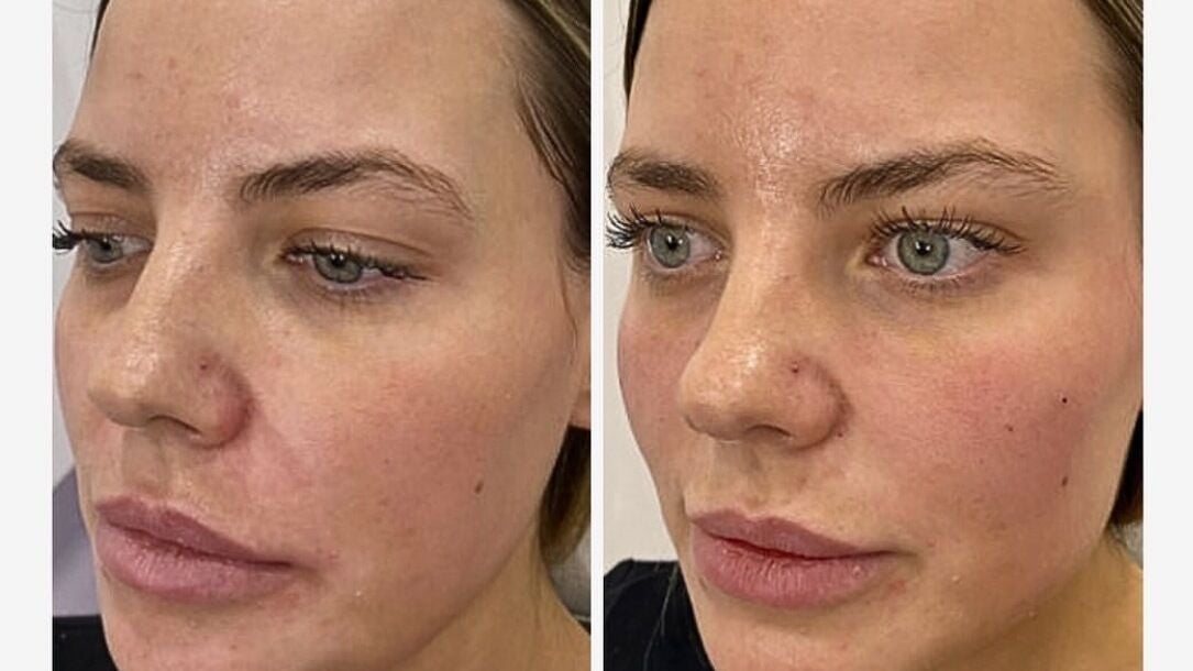 0b2d3b4e-ba05-4edd-bdc0-6fd67ee8b18a-theclinicaesthetics-gb-england-bath-fresha-6846100