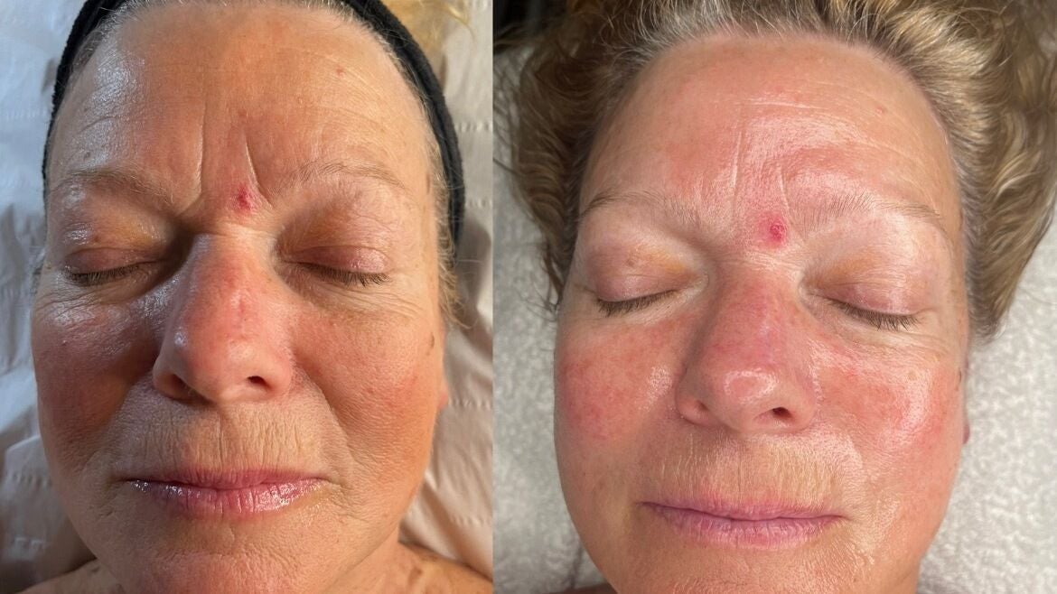 0be2dd97-13f7-4a49-966c-14ef428e303e-erholisticbeauty-gb-england-southwell-nottingham-fresha-9561871