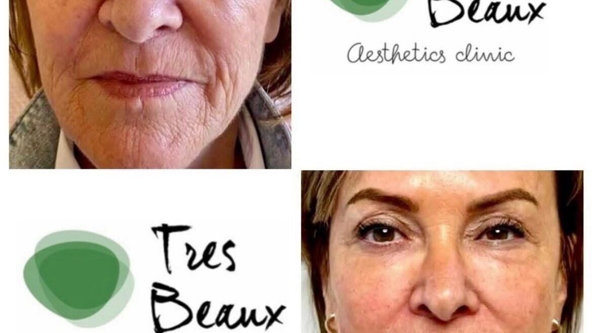 10dc3700-d31a-4316-ac62-b7a7cd60e80f-tresbeauxaesthetics-gb-england-birmingham-kingsnorton-fresha-9105128