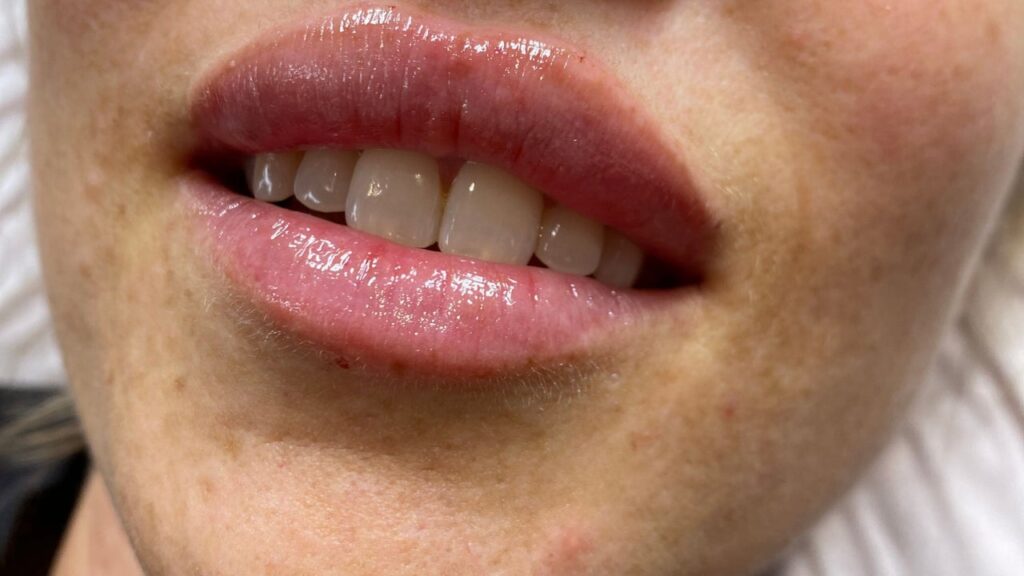 10fbaa62-4969-4ed6-b47c-5f88464e97c9-cuteaesthetics-gb-england-corsham-fresha-3384522