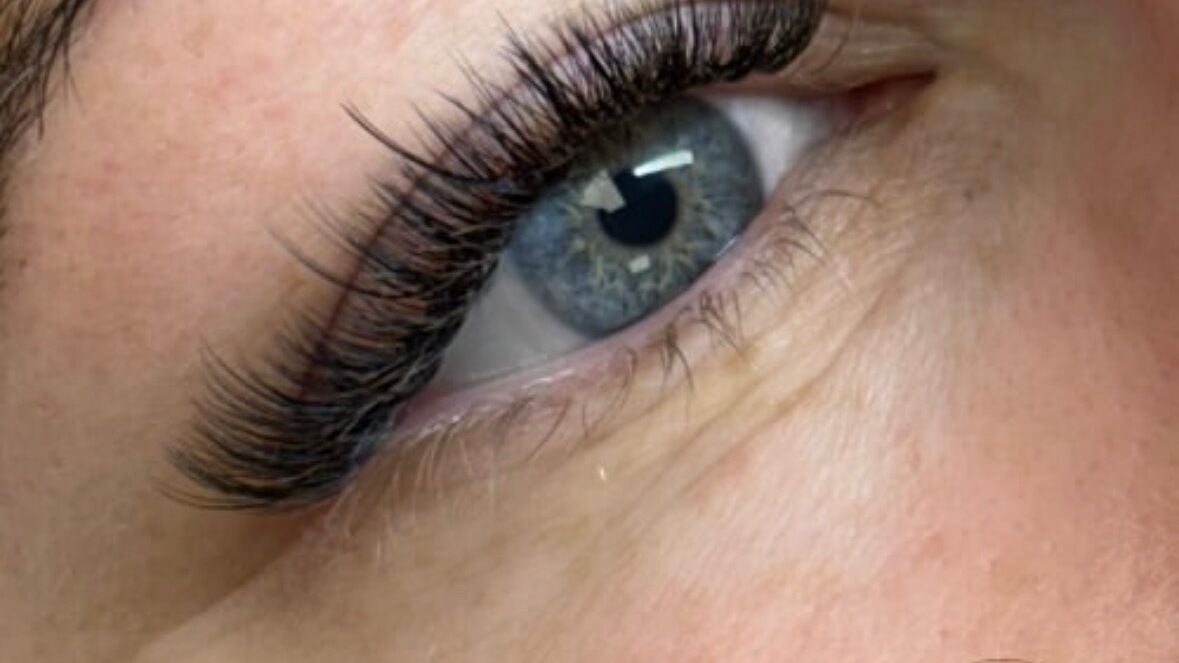 1406d3d9-1293-4733-bc37-69aecccc1180-lumalaserandbeauty-gb-england-salford-fresha-1393259