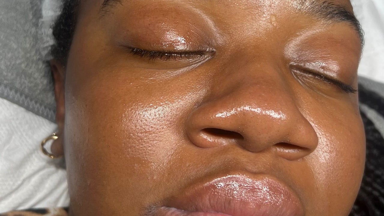 14986d30-c5db-4c1c-842f-a1a3f6dc7575-refreshskintherapy-gb-england-southampton-shirley-fresha-3948160