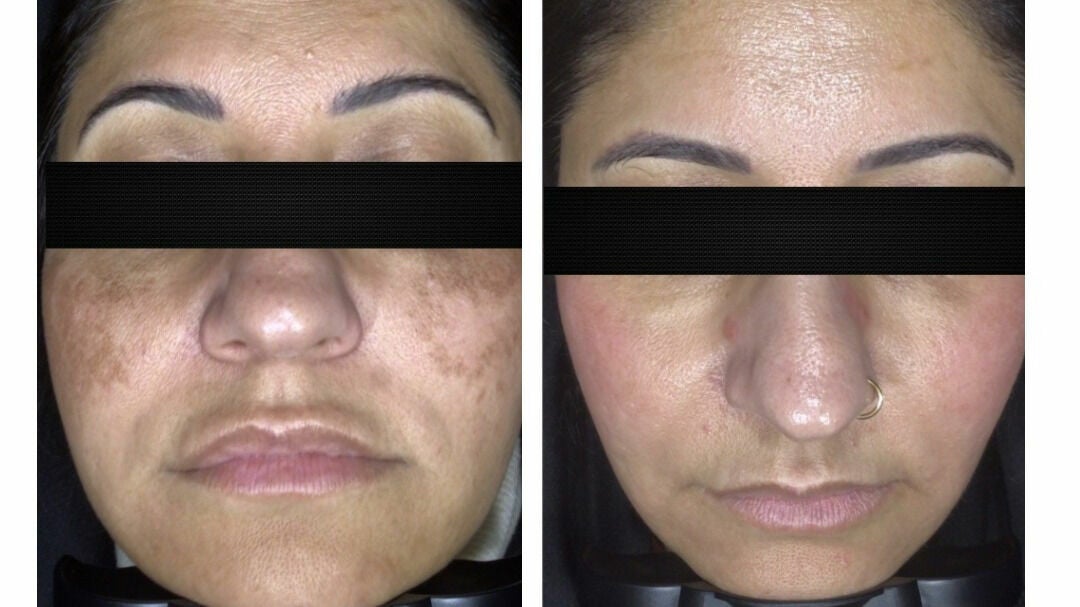 15722cfb-3007-48cf-9f06-5cc31be68d09-holliesskincare-garstang-gb-england-garstang-fresha-5439391