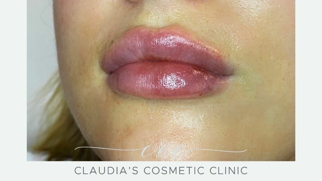 15bf6705-3cb5-4102-94c7-61a6116b7014-5780879