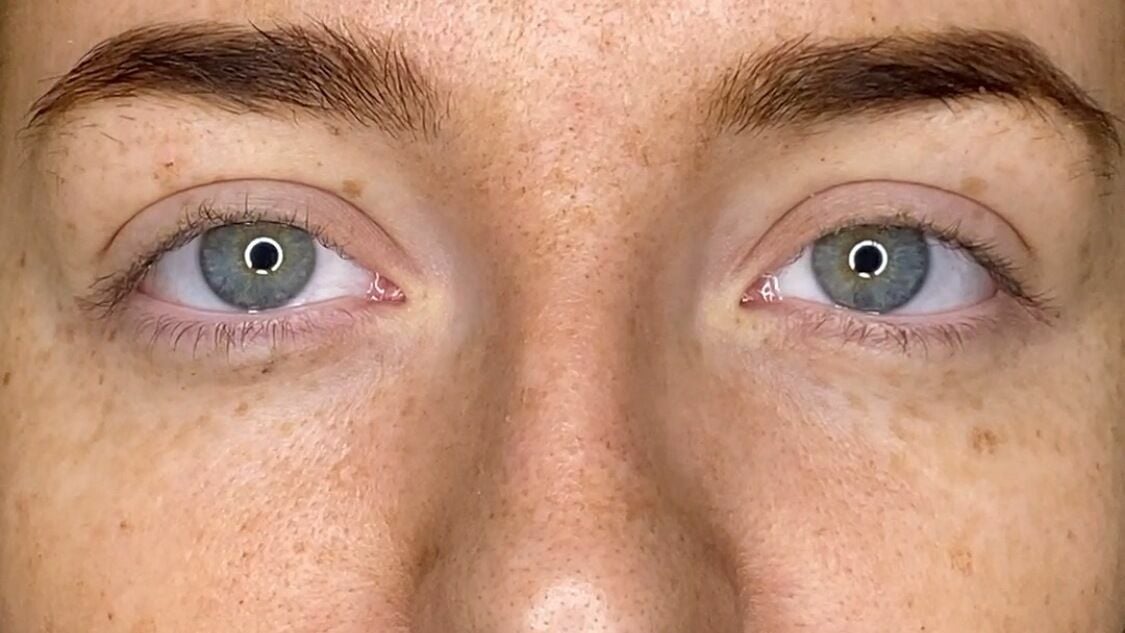 16a43929-c141-4510-bdb8-a550f3c8162a-greenhouseaesthetics-gb-england-sevenoaks-fresha-2883765