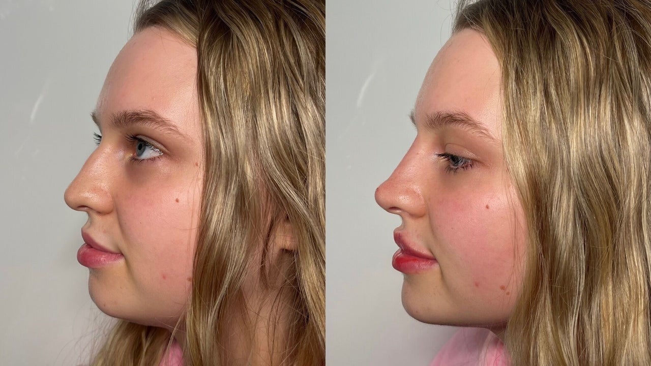 16d661f7-1936-4303-bafe-4182d4860231-bellamacaestheticsmanchester-gb-england-tyldesley-manchester-fresha-7357861