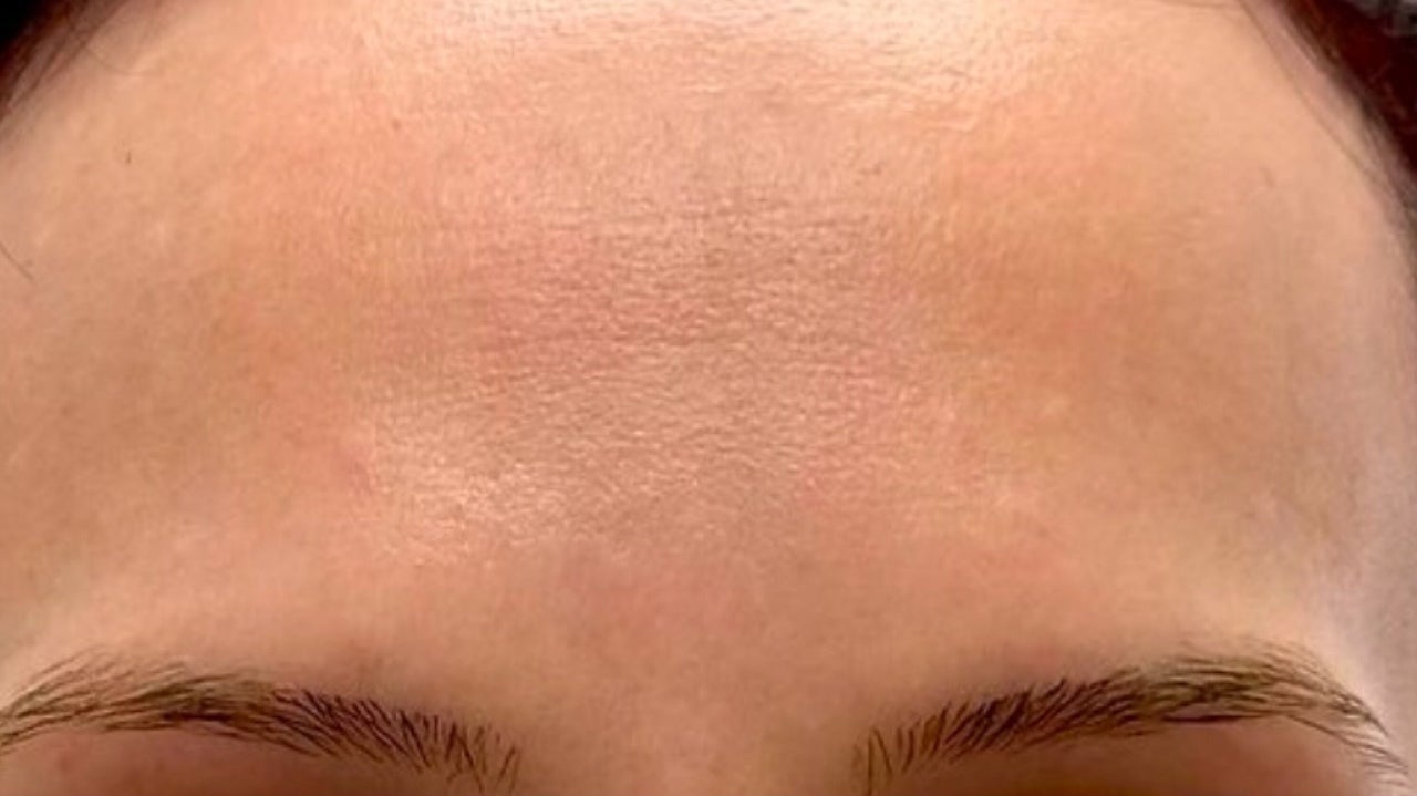 1739a5bd-aacf-4697-a645-47f4e0694729-anatomicaaestheticsamyyoungbscfdscbieassoc-gb-scotland-glasgow-dalmarnock-fresha-7685219