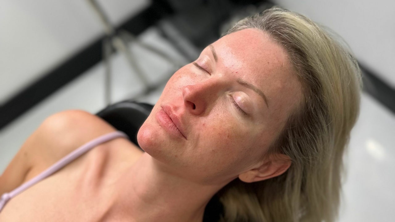 18229b64-b0b0-4fbb-941e-f160d365ef1c-reenuaesthetics-gb-england-cannock-cannock-fresha-4181327