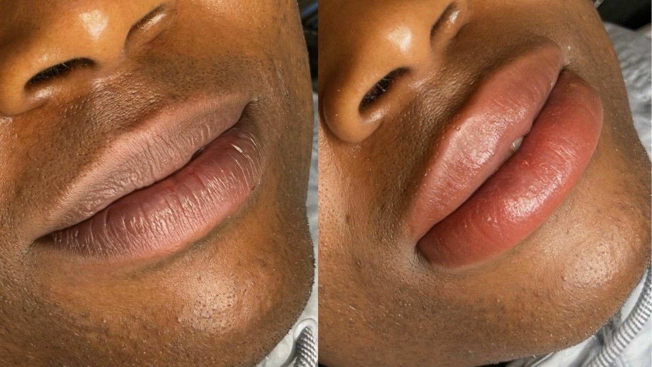 19e4a6b6-08e5-4d44-9661-266f4bdee721-rachelberrypmulaserandcosmetictattoo-gb-england-huddersfield-aspley-fresha-9909270