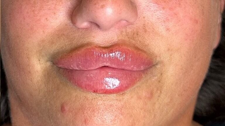 1a77cfd3-8c86-4d50-b5b6-5d258784cb8d-aspinallaesthetics-gb-england-kingswood-369-375twomilehillroad-fresha-6630012