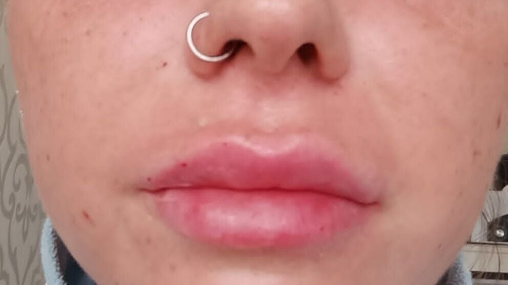 1ebb7e08-9cbe-4f3c-9e5b-c8141c47bf63-freshfaceaestheticshairandbeauty-gb-northernireland-belfast-fresha-7911651