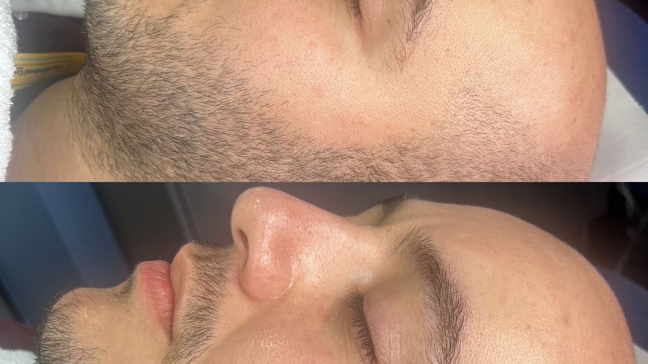 241f8e1e-50e4-4539-8590-e70fcebbdc7f-pulsarlaserchorley-gb-england-chorley-fresha-9936132