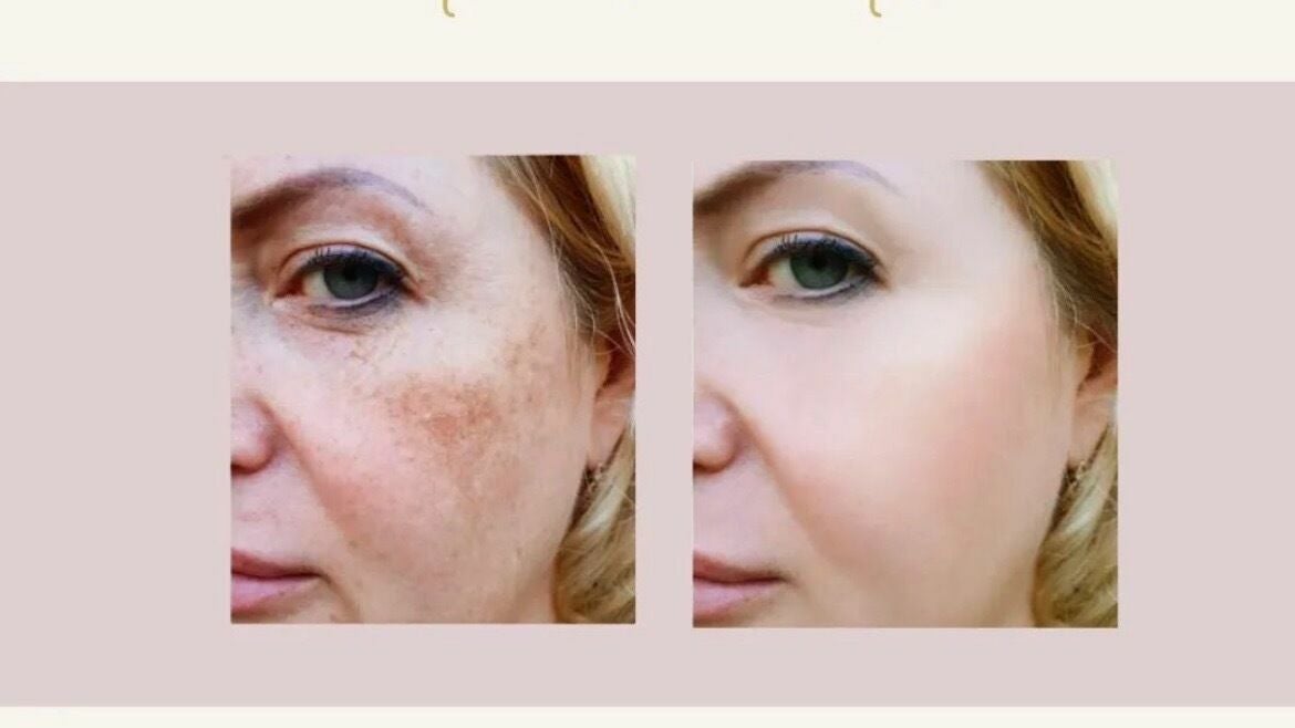 24d3c5d7-3c2b-4b76-b3db-dd3a92d0140f-freshglowaesthetics-gb-england-cheslynhay-cheslynhay-fresha-5787741