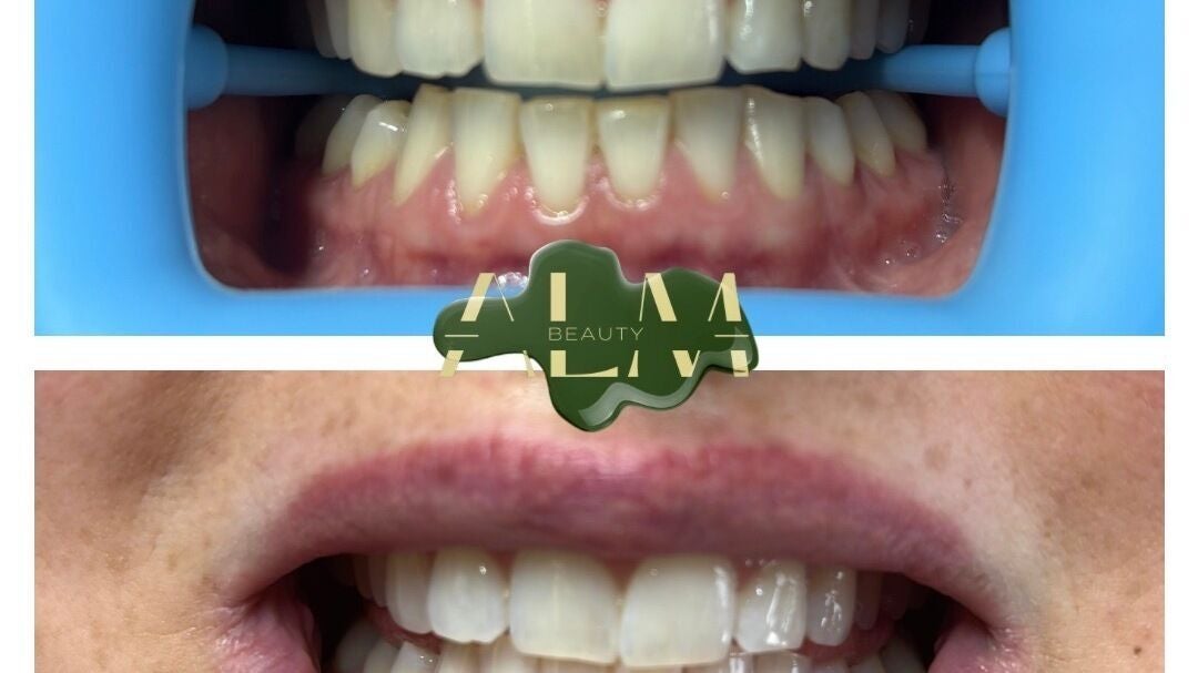 26c5f08b-ee45-4fb6-acf7-86bb87696746-almbeauty-gb-england-brightonandhove-brighton-fresha-3343952