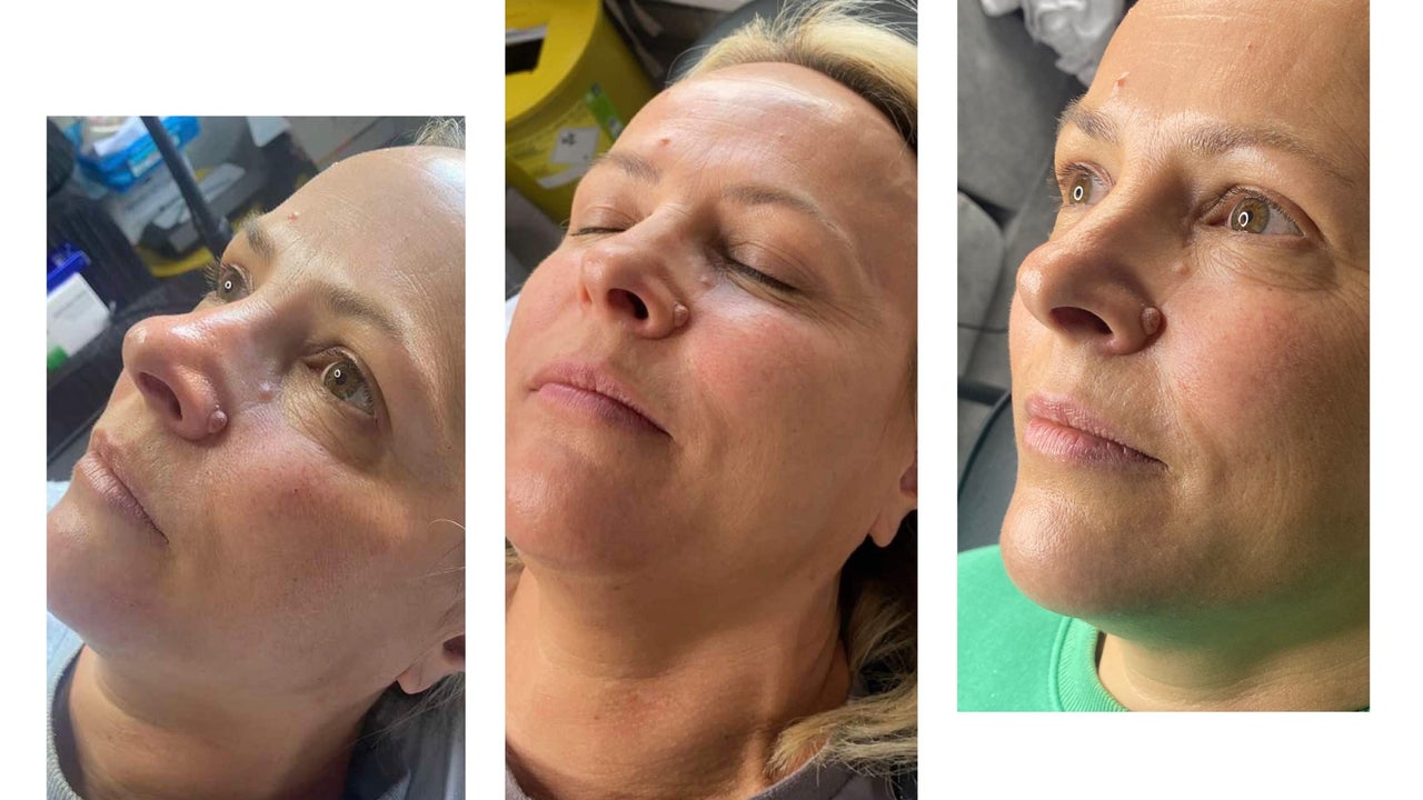 2848885a-484e-49f8-a985-5129445f8347-envymeaestheticsbeauty-gb-england-scunthorpe-fresha-4925516