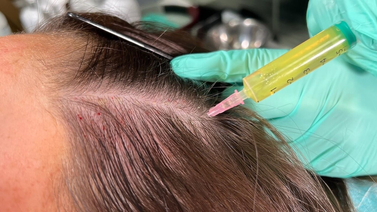 2ae71b74-ce44-4852-b4eb-4fcf6b5bbc4e-skinfinityaestheticstuebrook-gb-england-liverpool-tuebrook-fresha-3067920