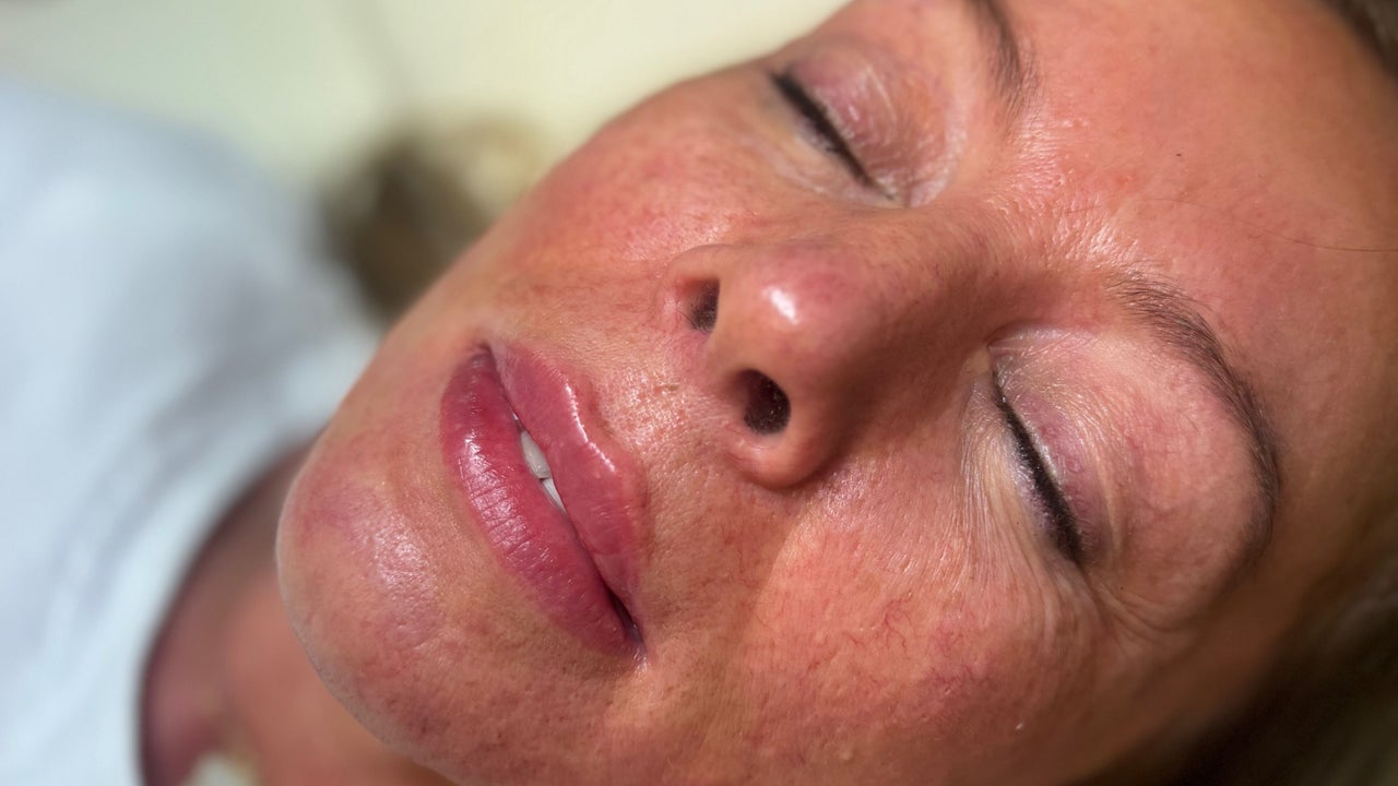 2b6b6d89-fd97-475f-9ebd-b43753152bf0-coveaesthetics-essex-gb-england-rainham-fresha-8647436