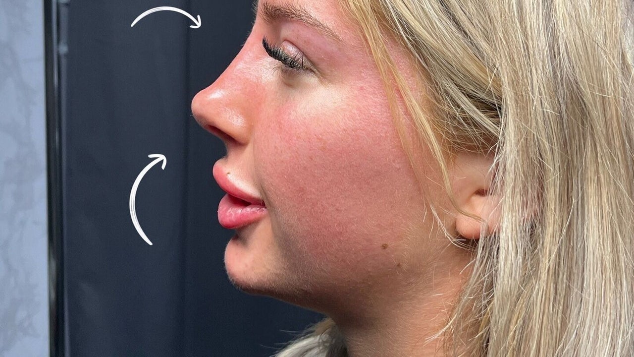 2b96a2f2-3e3f-4c7c-a46f-58a48a246857-bellamacaestheticsmanchester-gb-england-tyldesley-manchester-fresha-9909836