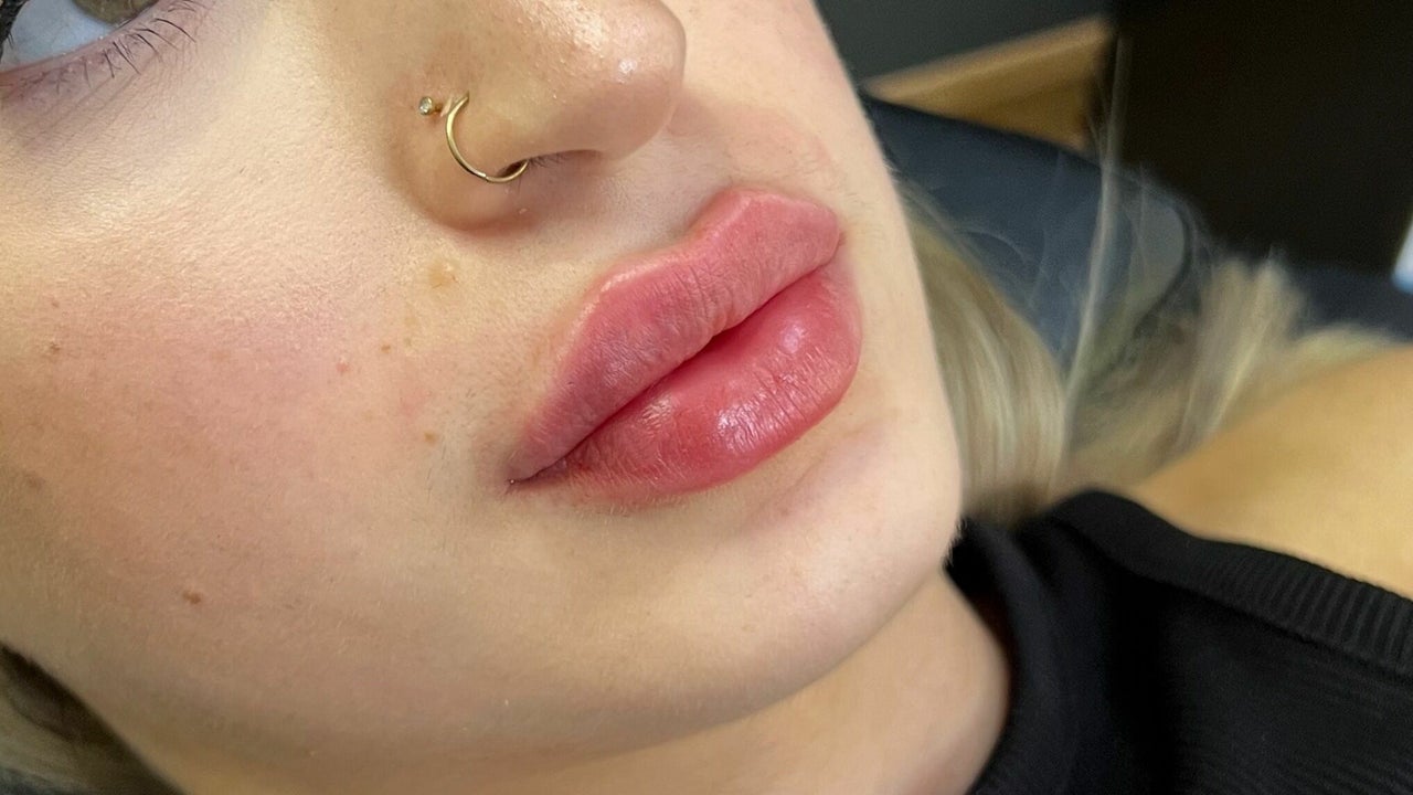 2ba17381-f3f3-4e53-9a51-abc403ffa1a2-9321767