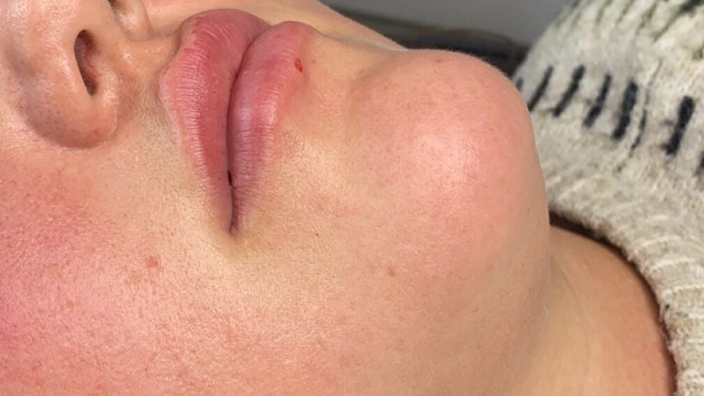 2c15bc06-aa95-4d88-bfbc-94871f085075-envymeaestheticsbeauty-gb-england-scunthorpe-fresha-9816010