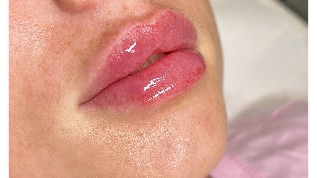 2c80e14b-fc03-46d7-a7b6-0c0594647534-kentbeautyandaesthetics-gb-tunbridgewells-fordcombe-fresha-3533477