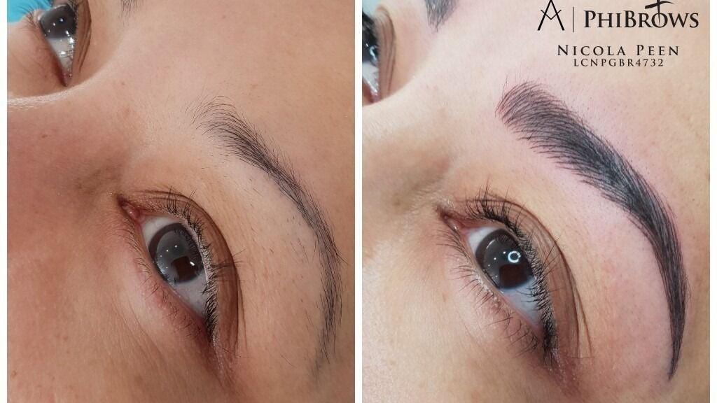 2ca82448-04d7-42e2-a0cb-0fe4db13f2d2-npaestheticsbeautyclinic-gb-england-maidstone-allington-fresha-9172596