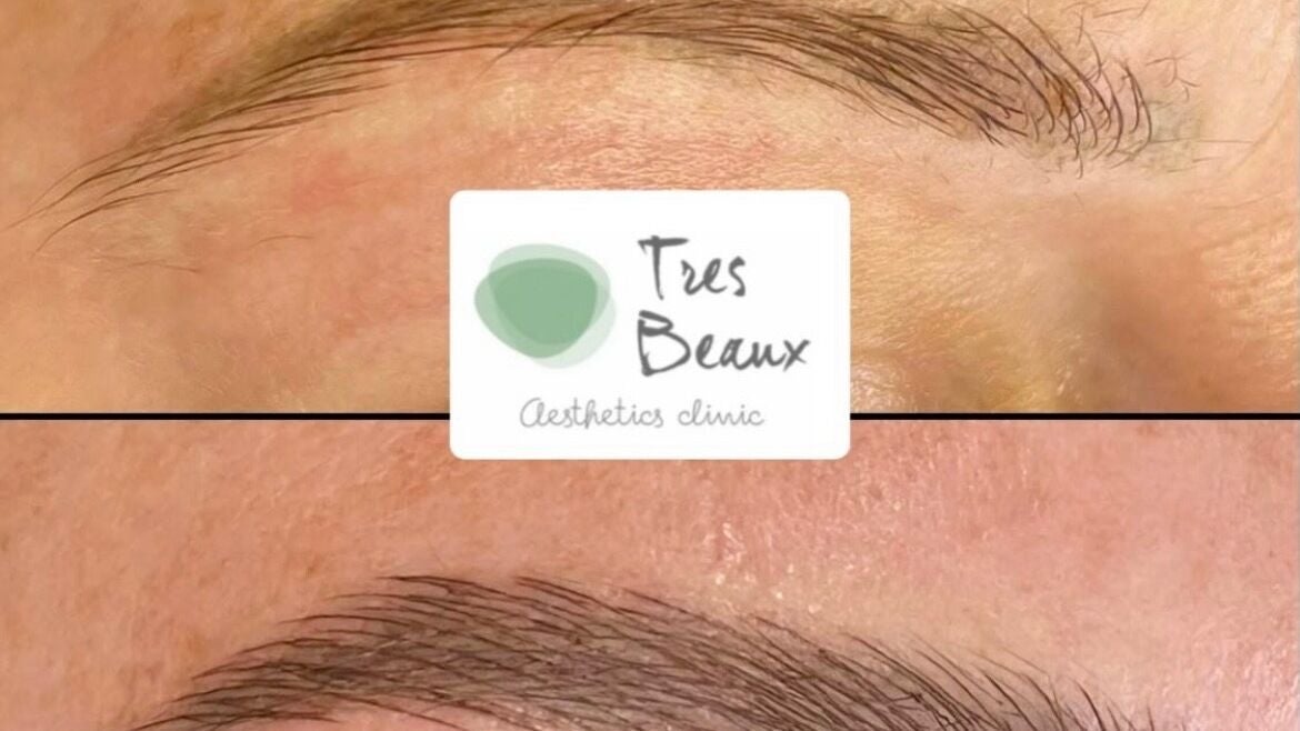 2fe56615-c481-49b1-9ee7-e6b9069e5c03-tresbeauxaesthetics-gb-england-birmingham-kingsnorton-fresha-8904701