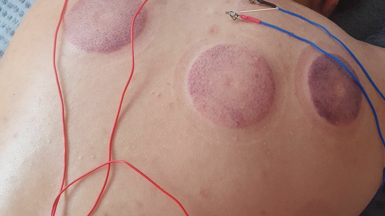 2ff8060f-446c-4894-9f5b-739e558b643f-7520116